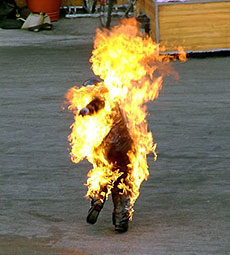 10-летний мальчик обгорел, играя с огнем