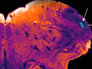 Скрытый участок мозга нашли нейробиологи
