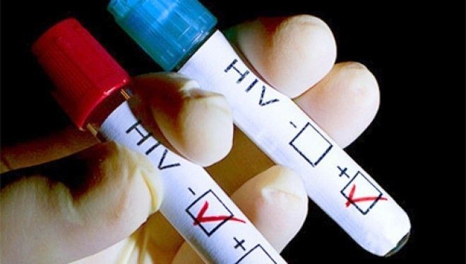 Тестирование на ВИЧ стартует завтра в Челябинске