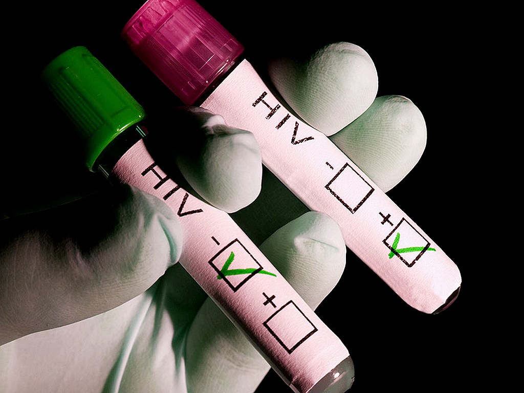 Челябинцы активно проходят тест на ВИЧ