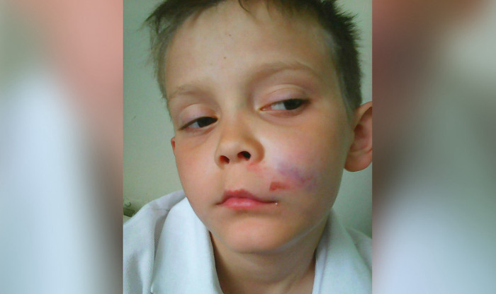 Ребенка избили старшеклассники в Полетаево
