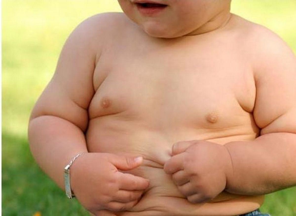 Самое частое заболевание детей в России - ожирение. В целом заболеваемость детей возросла за 18 лет
