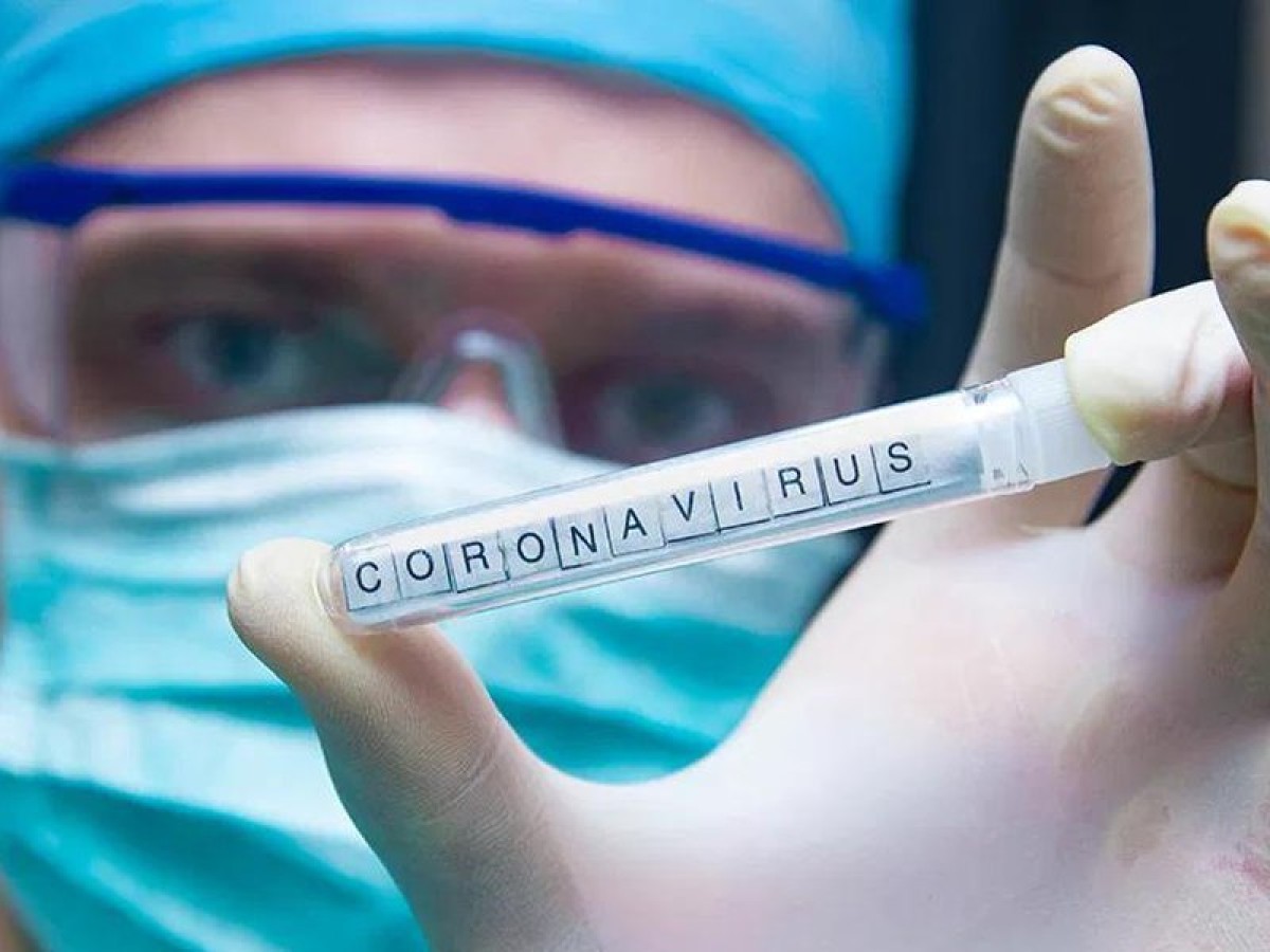 Коронавирусом заражены в России 840 человек