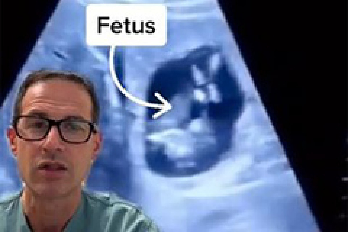 Ребенка обнаружили в печени у беременной женщины
